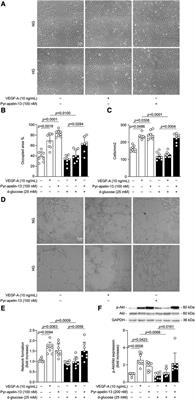 Apelin prevents diabetes-induced poor collateral vessel formation and blood flow reperfusion in ischemic limb